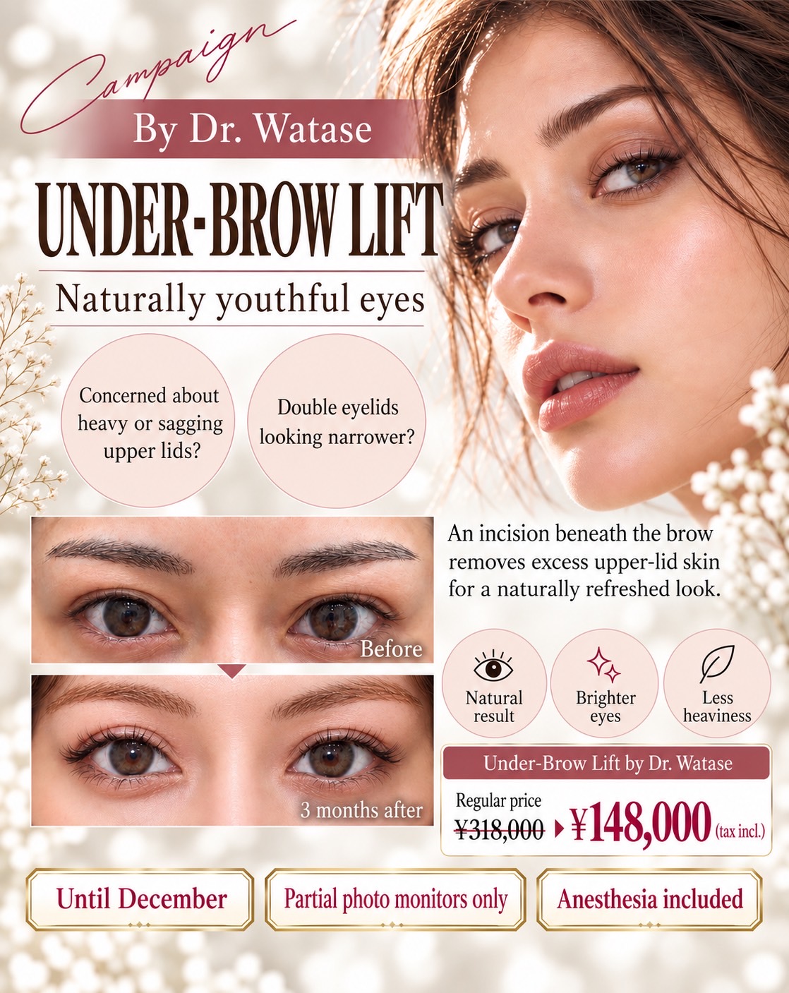 沖縄・那覇で眉下切開｜麻酔代込みキャンペーン/Sub-brow Lift in Naha, Okinawa | Campaign Including Anesthesia Fees