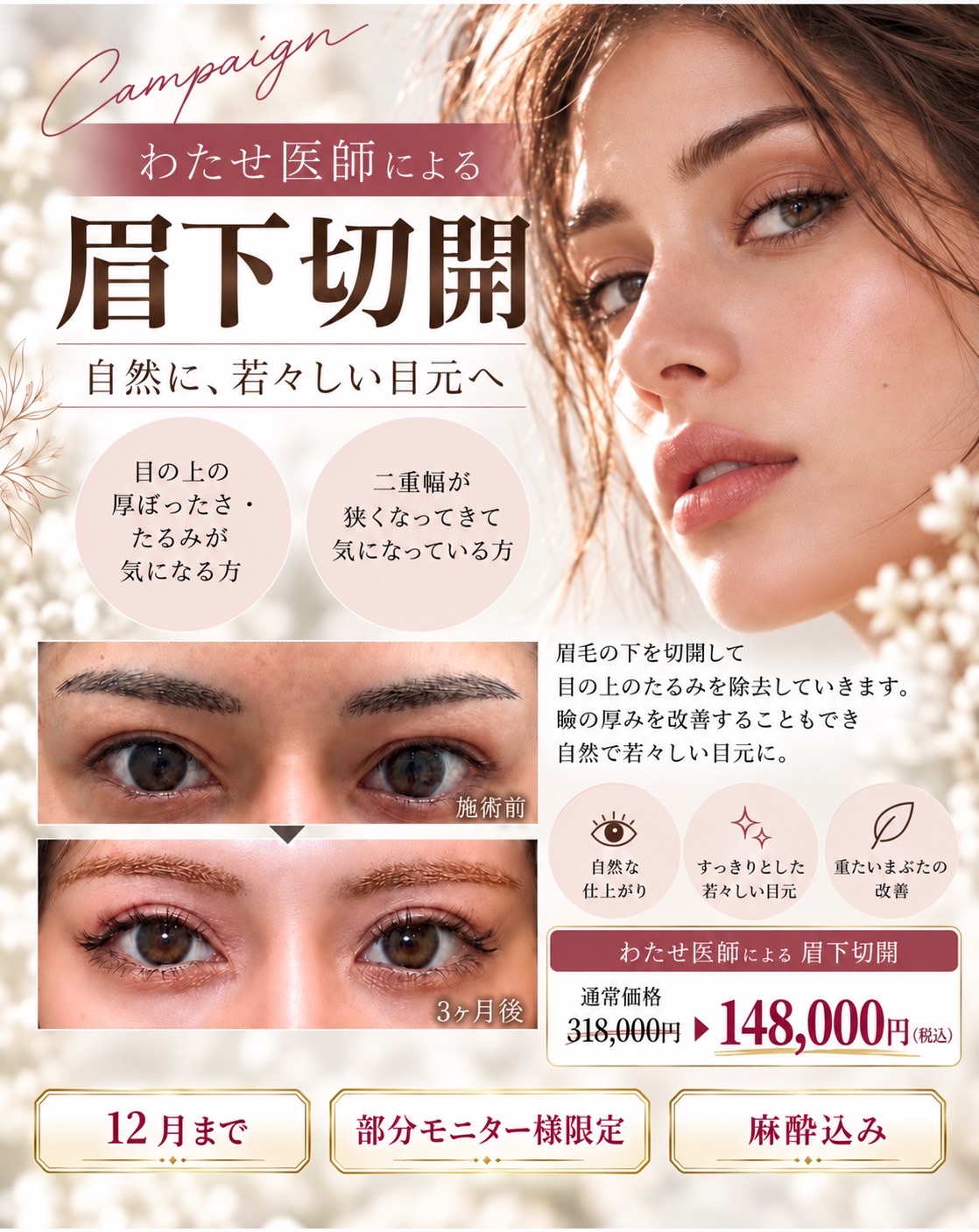 沖縄・那覇で眉下切開｜麻酔代込みキャンペーン/Sub-brow Lift in Naha, Okinawa | Campaign Including Anesthesia Fees